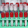 Přetrvávání ochranné hladiny protilátek a následná přeočkování u očkování proti KE