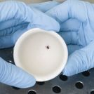 Současné trendy v epidemiologii klíšťové encefalitidy