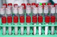 Přetrvávání ochranné hladiny protilátek a následná přeočkování u očkování proti KE